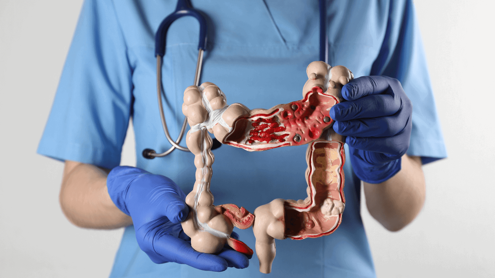 Consulta para Tumores Neuroendócrinos Gastrointestinais