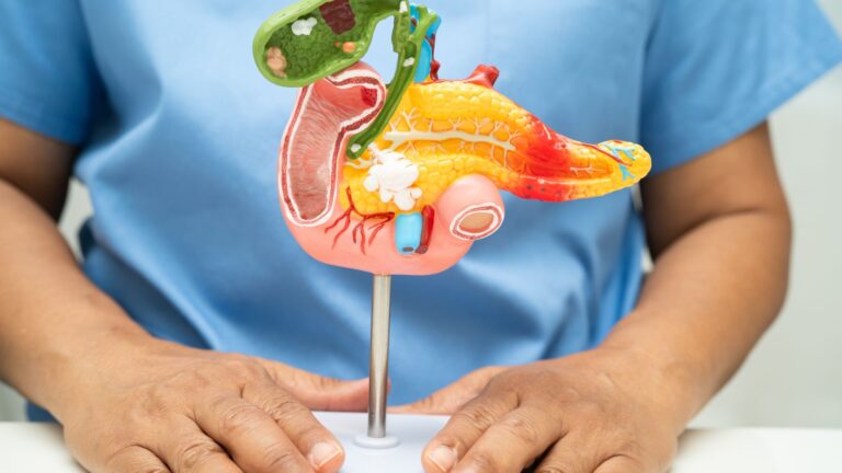 Cirurgia para Câncer de Estômago