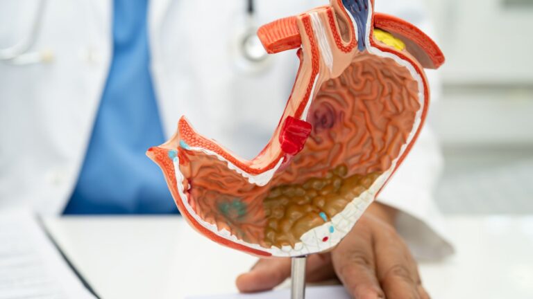 Câncer Gastrointestinal | Cirurgia