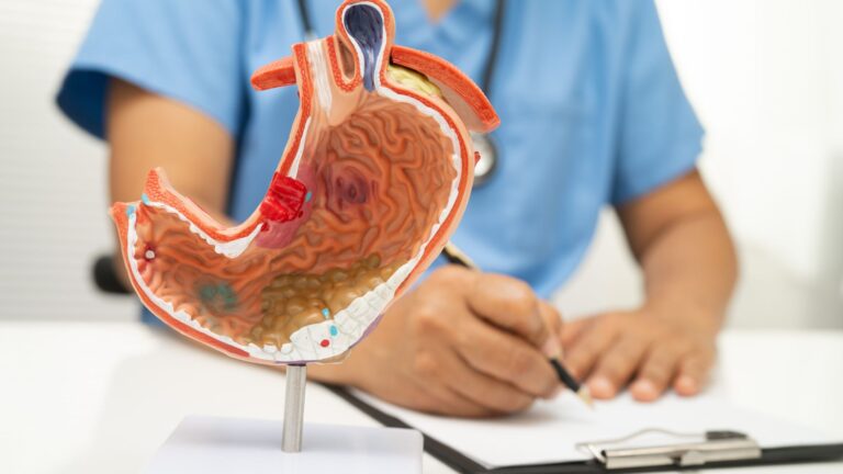 Cirurgia para Tumores Gástricos Benignos e Malignos