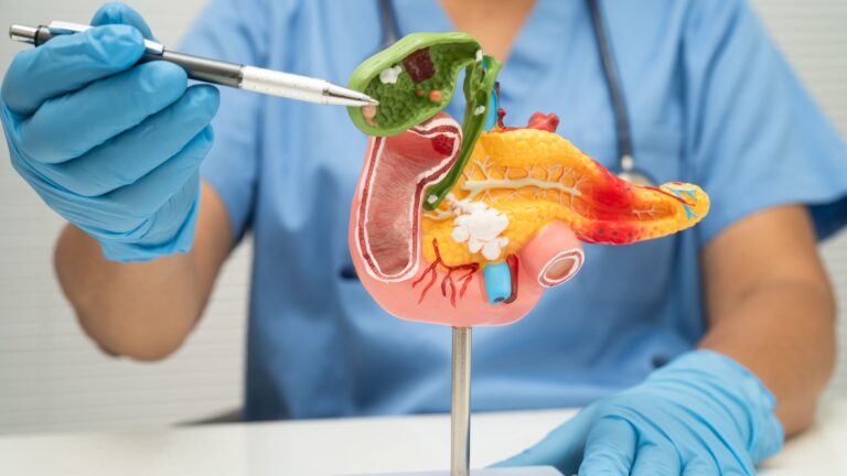 Tratamento para Recidiva de Câncer Digestivo