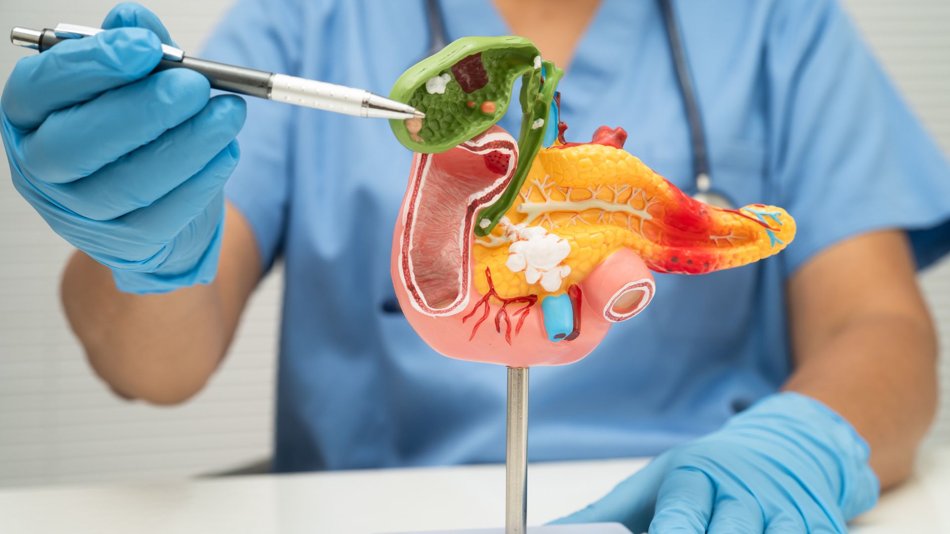 Descubra opções de tratamento para recidiva de câncer digestivo e como o Dr. Vinícius Simonetti pode ajudar você nessa jornada.