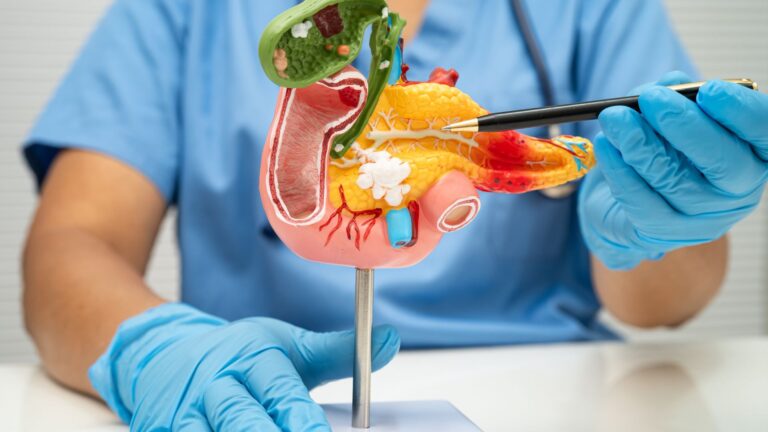 Câncer Gastrointestinal: Entendendo a Doença