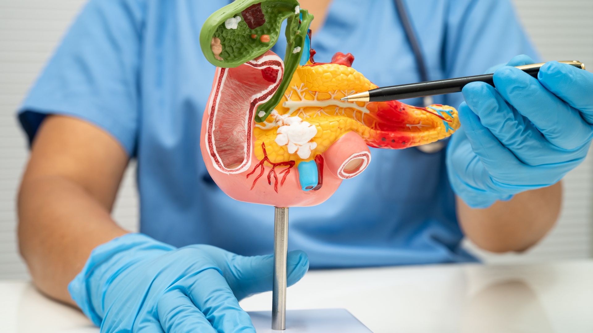 Descubra tudo sobre câncer gastrointestinal, seus sintomas, diagnóstico e prevenção. Informe-se para cuidar melhor da sua saúde.